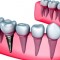 Что нужно для лечения и протезирования зубов?